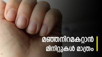  നഖത്തിന്റെ മഞ്ഞ നിറത്തിന് മൂന്ന് മിനിറ്റ് പരിഹാരം: പൊടിക്കൈകള്‍
