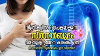ഓരോ 4 മിനിറ്റിലും ഒരു സ്ത്രീക്ക് സ്തനാര്‍ബുദം; മാരകരോഗം തടയാന്‍ ചെയ്യേണ്ട കാര്യങ്ങള്‍