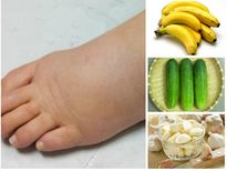 టాప్ 10 న్యాచురల్ రెమెడీస్ శరీరంలో నీరు తగ్గిస్తాయి!