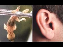 హడలెత్తించే విషయం: మనిషి చెవిలో తోకలేని బల్లి