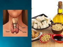 థైరాయిడ్ సమస్యను నివారించే హెల్తీ ఫుడ్స్ 