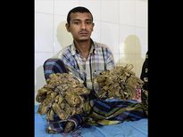 చెట్టంత మనిషి.. చెట్టులా మారిపోతున్నాడు