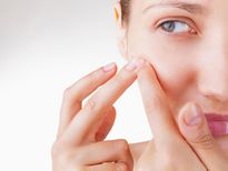 స్కిన్‌ బ్రేక్‌ అవుట్‌ అవుతోందా! ఇవి కారణం కావొచ్చు! 