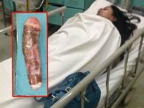 लड़की ने मजे-मजे में योनि में डाला कसावा, ले जाना पड़ा हॉस्पिटल 
