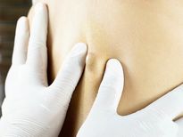 सिबेसियस सिस्ट से छुटकारा पाने के लिए अपनाएं ये 13 घरेलू उपाय 