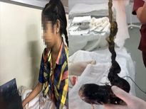 शॉकिंग.. लड़की के पेट से निकला 750 ग्राम बालों का गुच्छा, डॉक्टर्स भी हैरान...