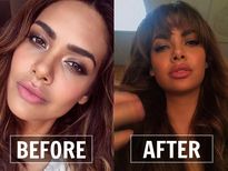 ईशा गुप्‍ता ने करवाई लिप सर्जरी! ये एक्‍ट्रेसेस भी करवा चुकी है Lip Jobs 