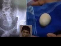  OMG! ये लड़का 2 साल से दे रहा है अंडे, डॉक्टर्स भी हुए हक्‍के बक्‍के...