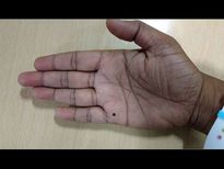 शरीर के इन हिस्सों में तिल कामयाब शादीशुदा ज़िंदगी की तरफ करती है इशारा