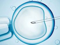 ICSI बेहतर है या IVF, जानें किसमें हैं गर्भधारण करने के ज्‍यादा चांसेज?