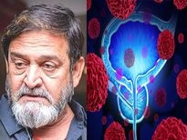 यूरिनरी ब्‍लैडर कैंसर की वजह से हुई महेश मांजरेकर की सर्जरी, जानें लक्षण कारण और इलाज