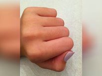उंगलियों के बालों से है परेशान, तो इन घरेलू उपाय से हटाएं अनचाहे बाल 