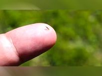  लंबी देर तक स्किन में फंसा कांटा भी बन सकता है नासूर, इन आसान तरीकों से न‍िकाले 