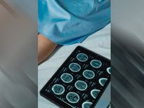 स्ट्रोक के बारे में कॉमन मिथ, इन फैक्ट्स के बारें में नहीं जानते होंगे आप 