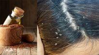 सर्दियों में फ्लेकी डैंड्रफ से राहत पाने के लिए ट्राई करें ये स्कैल्प टोनर