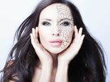 How To Banish Dry Skin