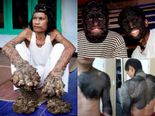 Genetic Mutations That Have Gone Wrong