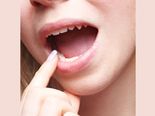 Foods To Eat After Removal Of Wisdom Tooth