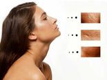 8 Ways To Shrink Your Pores In A Jiffy