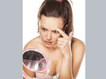 8 Remedies To Cure White Patches