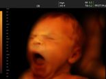 What Does The Baby Do Inside The Womb?