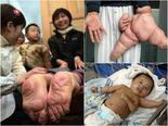 Unbelievable Genetic Accidents That Will Shock You 