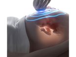 Side Effects Of Scanning During Pregnancy