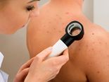 Try These Effective Natural Tips To Cure Back Acne 