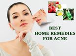 9 Incredible Home Remedies For Acne That Actually Work