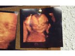 Amazing Ultrasound Images To Check