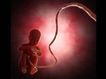 Microcephaly, A Condition Every To-Be Parent Must Be Aware Of! 