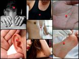 Press These Points And Get Rid Of Stress!
