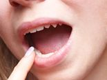 Signs Of Shocking Diseases Seen In Your Mouth First! 