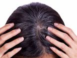 Home Remedies To Prevent Grey Hair, Which Really Work! 