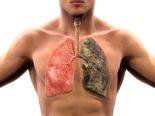 7 Common Things In Your House That Can Damage Your Lungs!