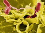 Salmonella Poisoning: Avoid These Foods!