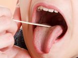 Do You Have White Spots In Your Throat? It Could Mean You Have These Serious Disorders! 