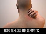 Home Remedies For Dermatitis 