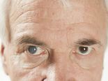 The Strange Story Of The ‘Sleepless Man’