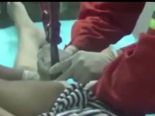 Man Got His Penis Stuck In A Wedding Ring!