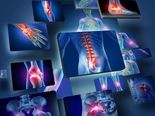 Best Herbs And Spices For Arthritis And Joint Pain