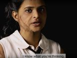 This Brave Acid Victim Sends Out Her Video CV On Social Sites