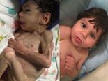 An Orphan Child Who Was Saved Looks Totally Different Now, Check It Out!