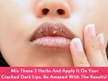 Mix These 3 Herbs & Apply It On Your Cracked Dark Lips, Be Amazed With The Results! 