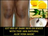 Get Rid Of Dark Skin On Knees With This 100% Natural Aloe Vera Mask!
