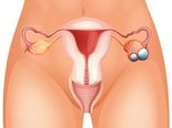Surprising Symptoms Of PCOS You Must Not Ignore