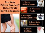 Are Your Calves Swollen? These Could Be The Reasons