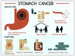 Facts About Stomach Cancer 