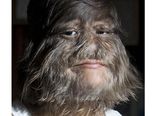 List Of Incredibly Hairy People