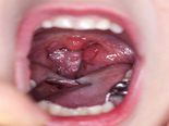 7 Simple Tips That Have Proven To Soothe A Sore Throat! 